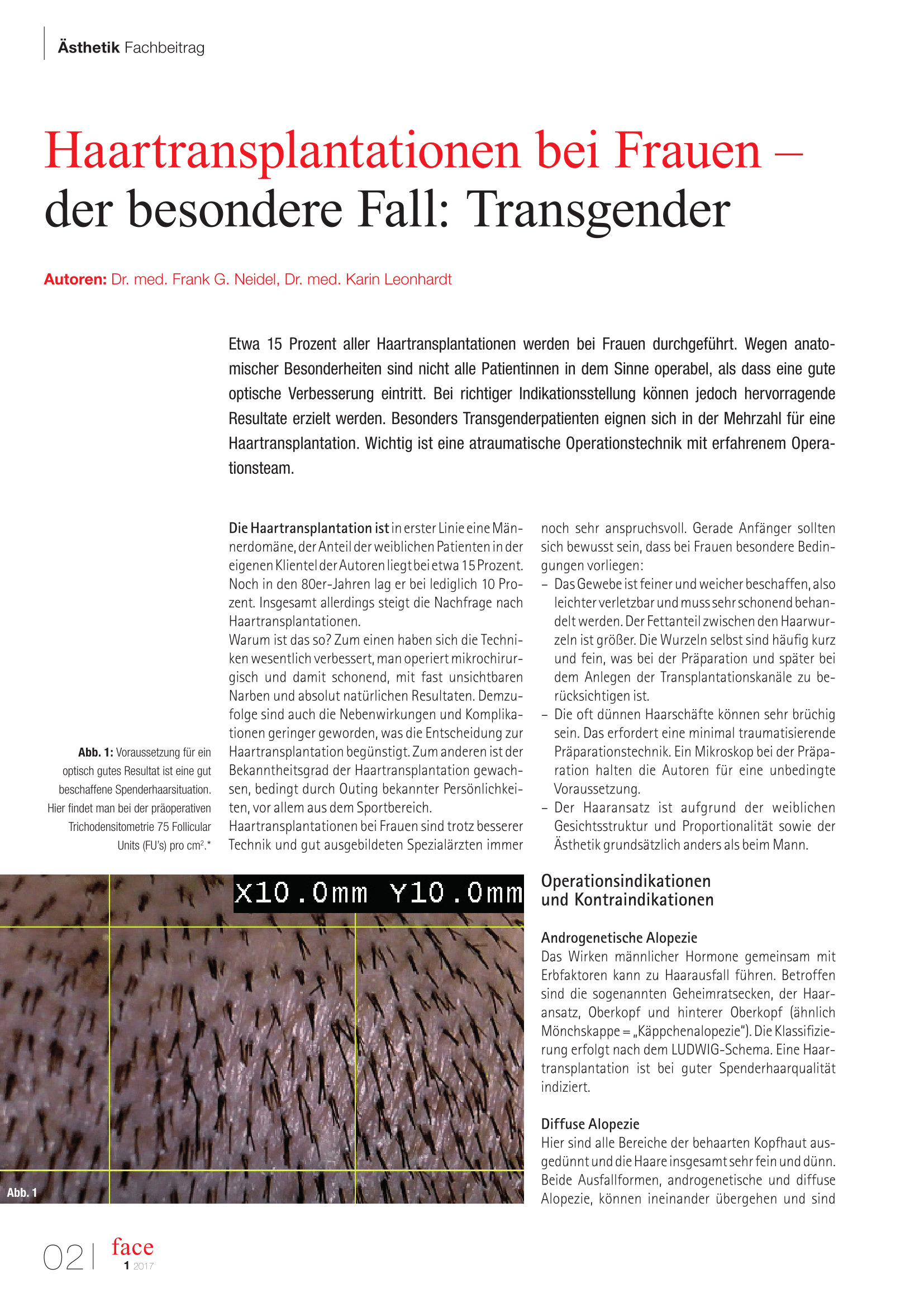 Transgender Artikel
